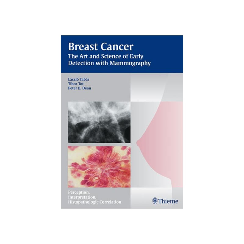 Breast Cancer - The Art and Science of Early Detection with Mammography - Perception, Interpretation, Histopathologic Correlatio